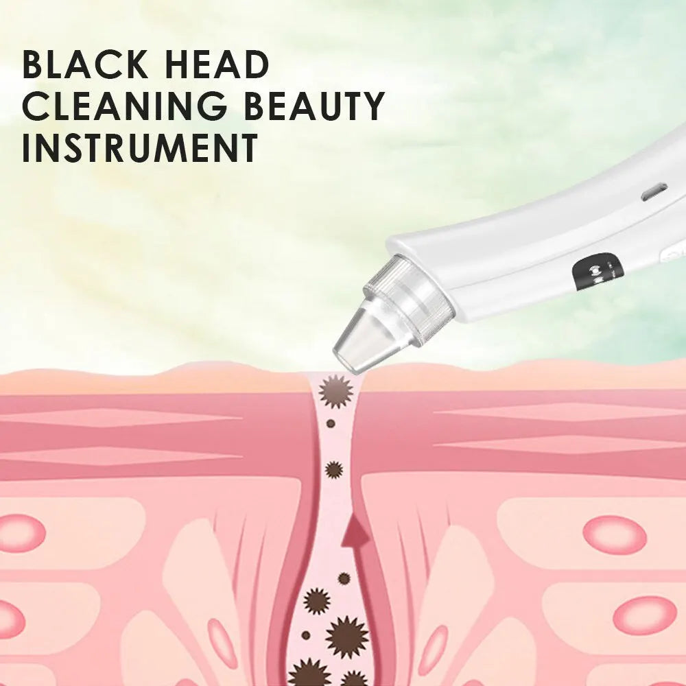 Cleansing Beauty Facial Blackhead Removal